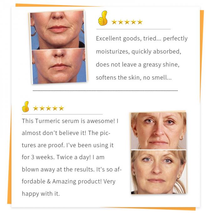 des Wesentlich-30ml reine Rötungs-leuchtende Haut modernes Rosacea 1 Gesichts-des Serum-100%
