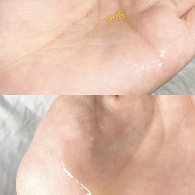 des Wesentlich-30ml reine Rötungs-leuchtende Haut modernes Rosacea 1 Gesichts-des Serum-100%