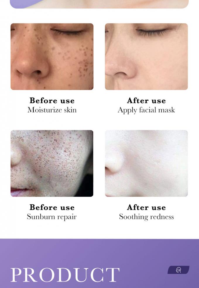des Wesentlich-30ml reine Rötungs-leuchtende Haut modernes Rosacea 1 Gesichts-des Serum-100%