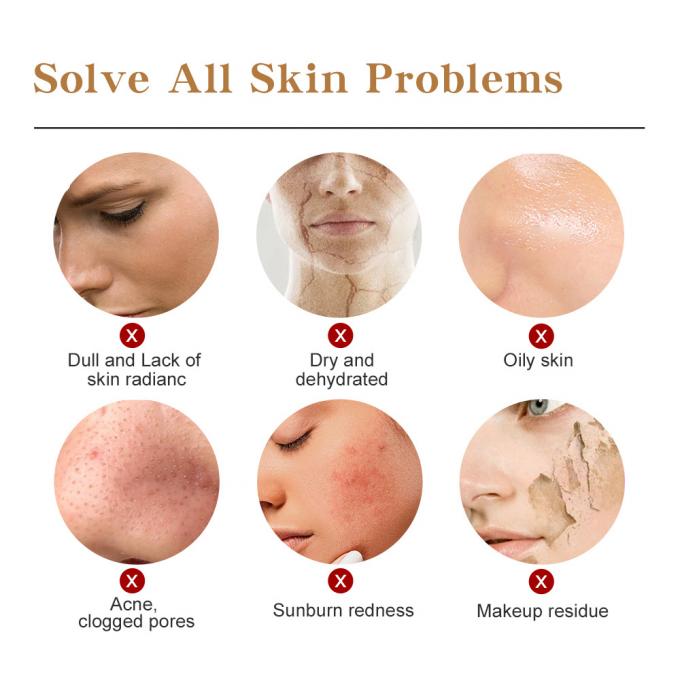 des Wesentlich-30ml reine Rötungs-leuchtende Haut modernes Rosacea 0 Gesichts-des Serum-100%
