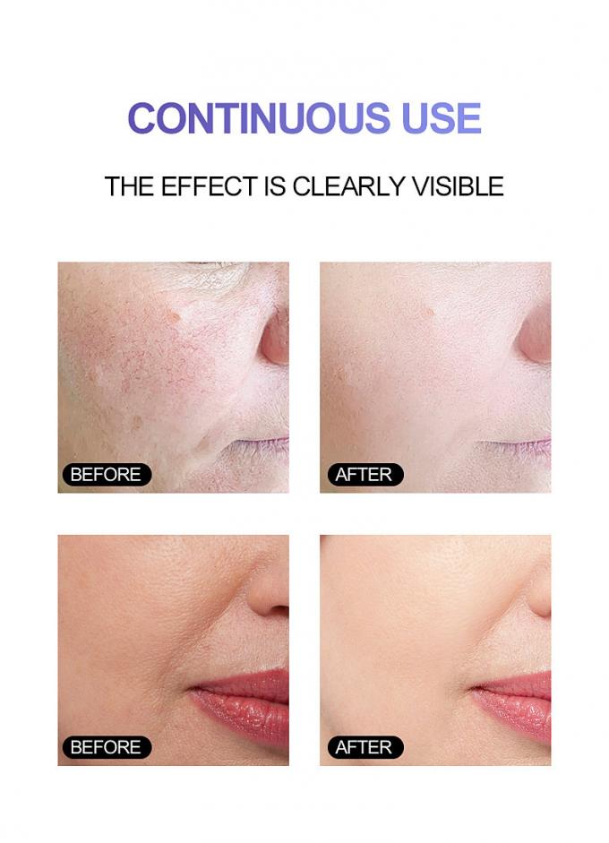 des Wesentlich-30ml reine Rötungs-leuchtende Haut modernes Rosacea 1 Gesichts-des Serum-100%
