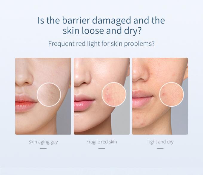 des Wesentlich-30ml reine Rötungs-leuchtende Haut modernes Rosacea 0 Gesichts-des Serum-100%