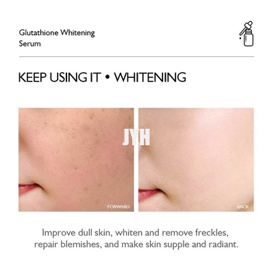 Glutathion, das Gesichts-Verjüngungs-Serum 30ml 1oz ODM korrigiert