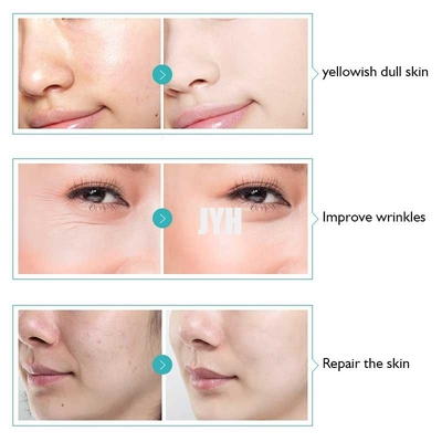 Apple-Stammzelle-Falten-Abbau-Serum-Antioxidansserum für empfindliche Haut