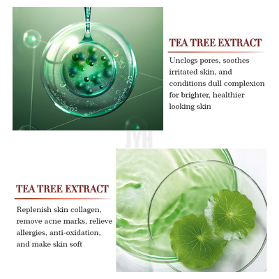 Tee-Baum-Entlastungs-Wesentlich-Gesichts-Serum-Reparatur-Akne-Pickel-Entferner Soems 1oz/30ml organischer
