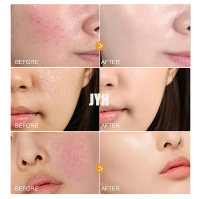 MSDS Gesichtspflegeprodukte Bio-Kamillenblüten-Serum Natürliches Gesichtsserum für empfindliche Haut