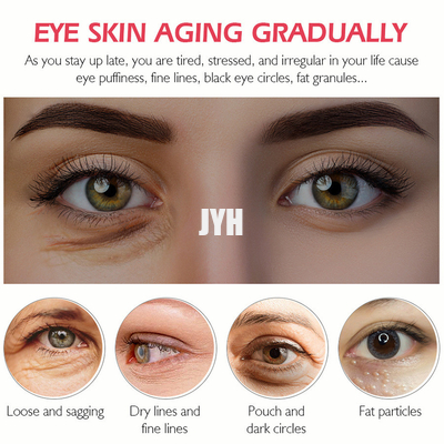 Kosmetik-Protein-Fest machen des Eyecare-20g und erleichternde dünne Linien Augen-Creme befeuchtend