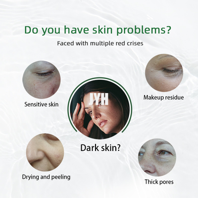 Der Haut-freundlichen schwarzen Flecke alternde Antikundenbezogenheit des Reparatur-Serum-30ml